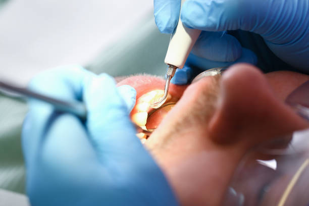Best Emergency Dental Care for Sports Injuries in Milford Mill, MD