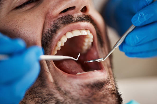 Best Emergency Denture Repair in Milford Mill, MD